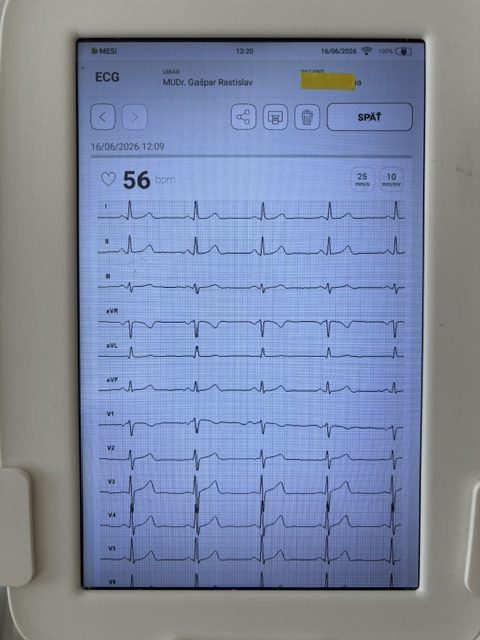 EKG vyšetrenie – ambulancia Pilumed